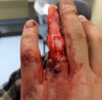 А потом будет вот так