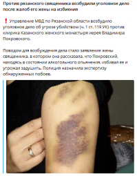 «Бьёт, значит, любит?»: как рассмотреть домашнего тирана и вовремя спасти себя?