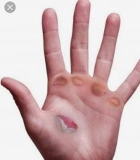 Утренний стояк: почему и что с ним делать?