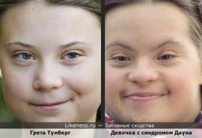 Мода на детей с синдромом Дауна навязывается наряду с модой на позднее рождение. Ибо риск родить такого ребенка с возрастом очень сильно повышается. 
Вот и весь "секрет" этих всех фотосессий...
А кстати, есть ведь ещё одна "принцесса", которая вполне вписалась бы в этот ряд. И это уже давненько подметили в сети: