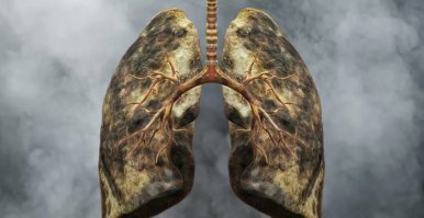 Город, который... смог