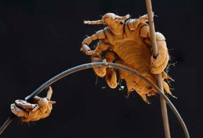 Господа!!! Активная общественность всего мира трубит о вымирании целого вида живых существ на нашей планете! Из-за применения пестицидов, дустов а так же тотального бритья вымирают целые колонии <span style='color:gray'>[мат]</span>! Им просто негде размножаться!!! Призываю всех сознательных людей, НЕ БРИТЬСЯ!!!! Нигде!!! Еще 5 лет подбривания, и мы останемся без целого вида живых существ!!!! Не допустим уничтожения <span style='color:gray'>[мат]</span>!!!! Сохраним популяцию, хотя бы на территории России!!!