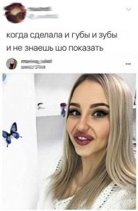 Только денег не хватило косоглазие подправить....