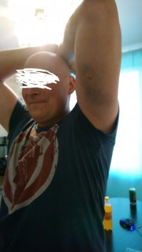 экип должен быть. Наглядно это понимаешь , когда пару десятков метров прокатишься на попе и спине по асфальту. Фото после того как меня сбил бмв , благо был в полном Итальянском экипе знаменитого производителя.