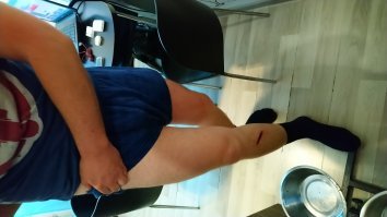 экип должен быть. Наглядно это понимаешь , когда пару десятков метров прокатишься на попе и спине по асфальту. Фото после того как меня сбил бмв , благо был в полном Итальянском экипе знаменитого производителя.