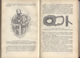 Я не понял, кто кого хочет задушить... (возьмите коробочку с запятыми на полке). А вот таких учебников уже давно нет, и вряд ли когда-то появятся...