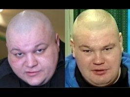 Однояйцеголовые близнецы