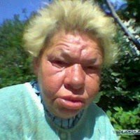 Причины отекания лица и глаз по утрам, способы их устранения и предупреждения