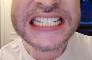 Какой бред))) Если ухаживать за зубами, то такого не будет, говорю как любитель виски с колой, белого вина.