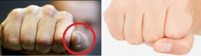 Ну кто же так палец ставит при ударе? при ударе вылетит сразу.