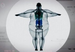 как-то так выглядит широкая кость