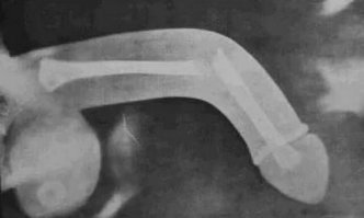 А вот и иллюстрация...