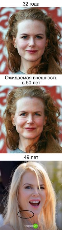 Шея выдаёт возраст.