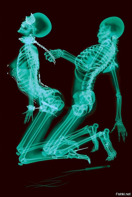 18 рентгеновских снимков, которые врачи запомнят надолго