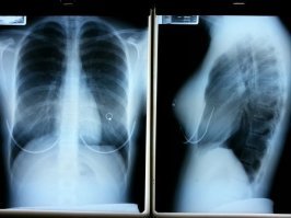 18 рентгеновских снимков, которые врачи запомнят надолго