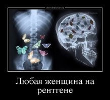 18 рентгеновских снимков, которые врачи запомнят надолго