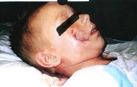 Обратная сторона "милых" зубов.