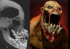 18 рентгеновских снимков, которые врачи запомнят надолго