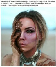 Какие назуй "винные пятна"!? Эта 3,14зда в грязи извалялась! Или в говне, хз, у всех свои тереканы.