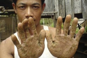 конечно безвредна, например в странах "третьего мира" активно применяется при добыче золота., местного золотоискателя не с кем не перепутаешь