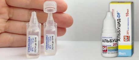 Зачем нужны какие-то народные средства с сомнительным результатом, когда есть медицинские проверенные препараты.
Цена 15 руб