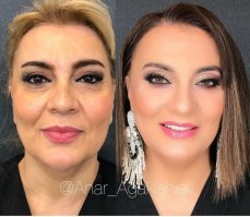 Многие "после" зафотошоплены так, что носы едва-едва угадываются на лице...