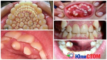 А так с зубками шутит природа..