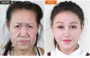 Напоминает иллюстрацию к популярной ныне теме в сети. Что произошло со мной после того как я бросил пить.