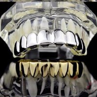 Глядя на некоторые фотки, древний анекдот вспомнился:
 Пришёл новый русский к стоматологу. Открывает рот. Стоматолог в шоке - нижняя челюсть золотая, верхняя - платиновая.
 Врач удивляется:
 - А что лечить то?
 - Лечить не надо - сигнализацию поставить надо!