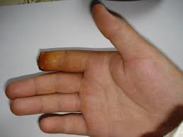 А что, так можно было,?