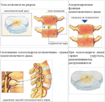 Чтобы моя жена не носила грузы ни в руках, ни на голове - я купил ей машину.
Недорогую, но - свою.
А жесткие проблемы с позвоночником после 40 лет пусть эти умники оставят себе, и лечат позвоночную грыжу.
Сравнивать себя со странами, где очень немногие доживают до 50 лет - не собираюсь.
Удачи автору поста.
.