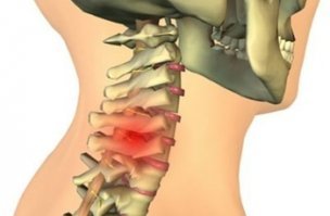 Чтобы моя жена не носила грузы ни в руках, ни на голове - я купил ей машину.
Недорогую, но - свою.
А жесткие проблемы с позвоночником после 40 лет пусть эти умники оставят себе, и лечат позвоночную грыжу.
Сравнивать себя со странами, где очень немногие доживают до 50 лет - не собираюсь.
Удачи автору поста.
.