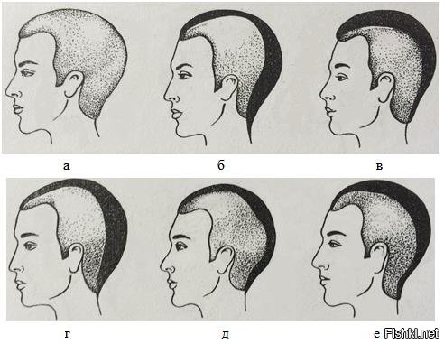Форма затылка. Форма головы для парикмахеров. Куполообразная форма головы. Формы головы человека и прически.