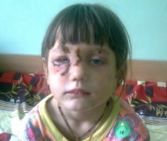 Обратная сторона медали.