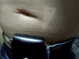 Я тоже играл. Только мои игры на моей тушке вот такие отметины (их намного больше, только вот порно тут уж совсем устраивать ни к чему):