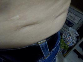 Я тоже играл. Только мои игры на моей тушке вот такие отметины (их намного больше, только вот порно тут уж совсем устраивать ни к чему):