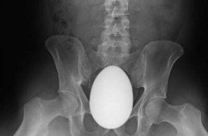 18 рентгеновских снимков, которые врачи запомнят надолго