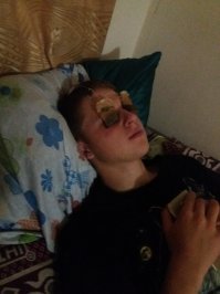 скорее всего на практике глаза обжег электросваркой - это самый бюджетный способ снятия боли
более продвинуто - закапать глаза новокаином, тогда вообще жить можно