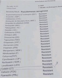 Антибиотики без рецепта запретили потому, что