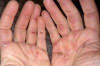 Гребля... Знаем мы эту греблю! 
А уши у борцов часто ломаются и немного обвисают, а не кровь там застаивается.