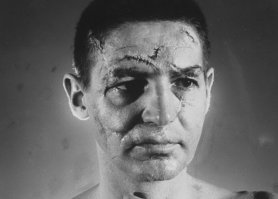 Лицо Терри: более 40 попаданий шайбы в лицо (согласно советской спортивной литературы)...