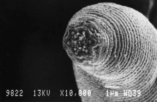 Да это какая то личинка. Дождевой червь даже под микроскопом - дождевой червь )))