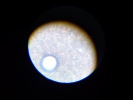 Сегодня у меня второй выходной. Завтра на работу. Сегодня я вам представляю...... Дрожжевой гриб при увеличении в 640 раз)))) вид из микроскопа. Довольно тяжело было сделать это фото телефоном))) этот парнишка вырос буквально за 1 час)))