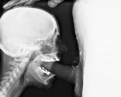 Здесь ничего ужасного, пациентка жива и даже довольна!