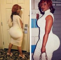 Дол.б.аные импланты...по мне - уродливая мода