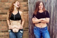 А куда делась растянутая кожа?