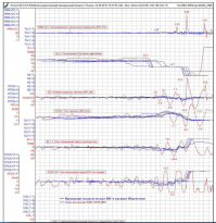 А мы тут которого пилоты выгораживаем? Капитана? Второй пилот должен был в своём направлении рулить или что? 

Взлетать он никуда не собирался, рули смещались туда, куда им ручкой задавали. Хватит тень на плетень наводить -