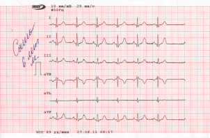 Это по молодости. Потом вот так