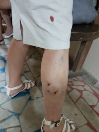 ничего смешного, в ногу успеет пару укусов наделать, прежде чем собьешь ее нафиг.