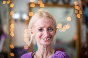 Тиффани, 41 год. 

PS Да, да, у неё прогерия.